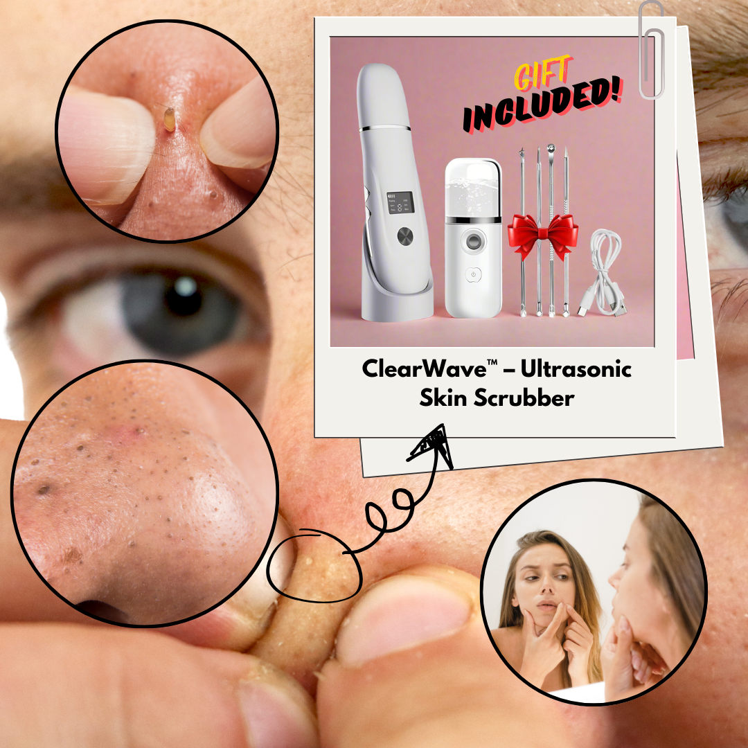 ClearWave™ Ultrasonic Skin Scrubber