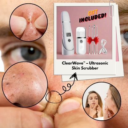 ClearWave™ Ultrasonic Skin Scrubber