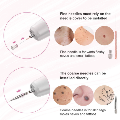 ClearMole™ – Precision Spot Removal Made Easy