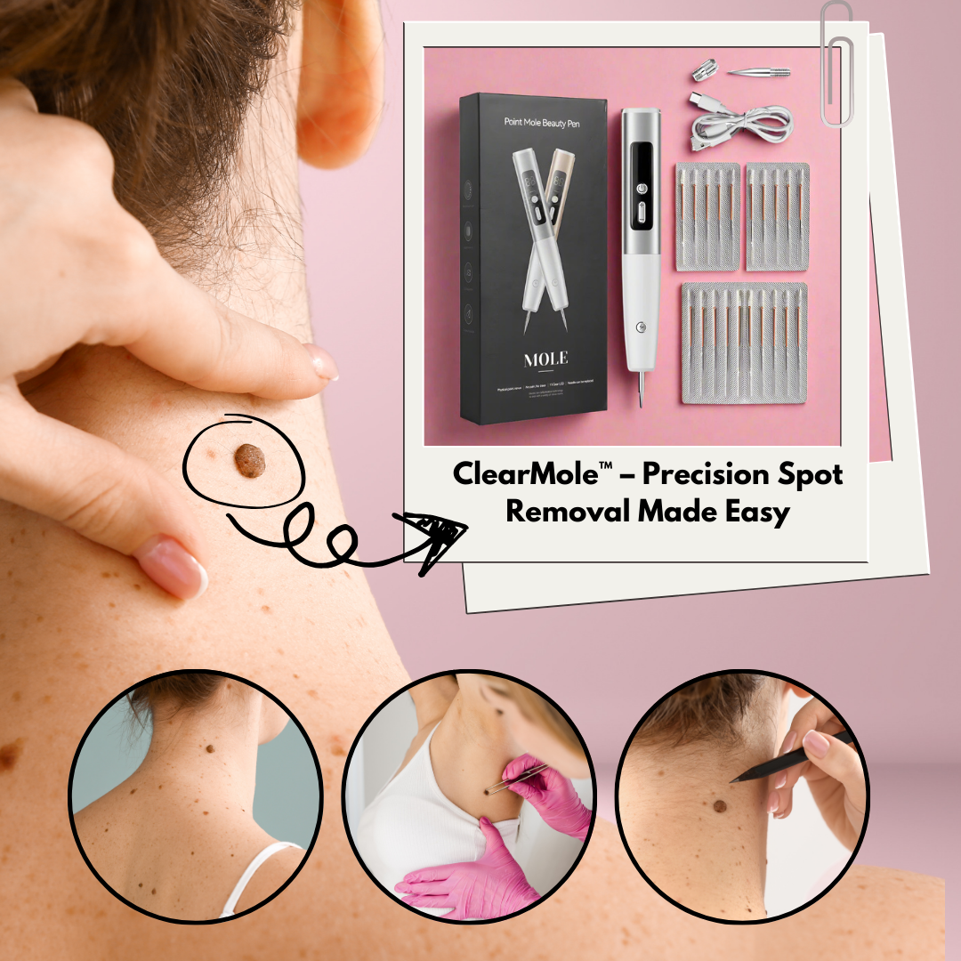 ClearMole™ – Precision Spot Removal Made Easy