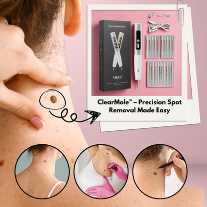 ClearMole™ – Precision Spot Removal Made Easy