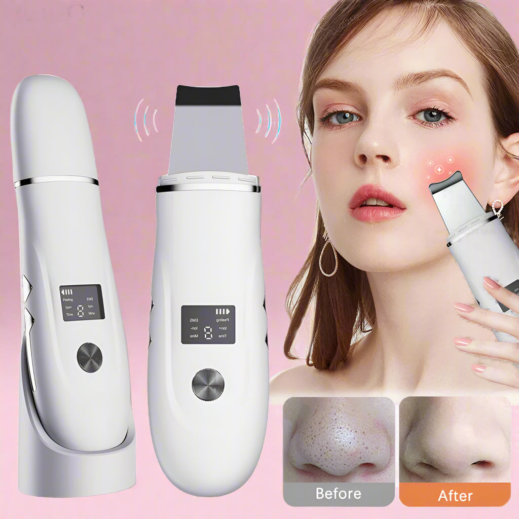 ClearWave™ Ultrasonic Skin Scrubber