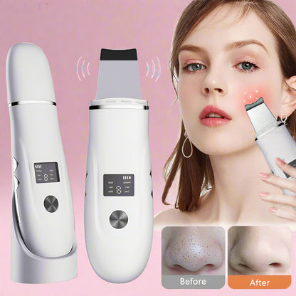 ClearWave™ Ultrasonic Skin Scrubber