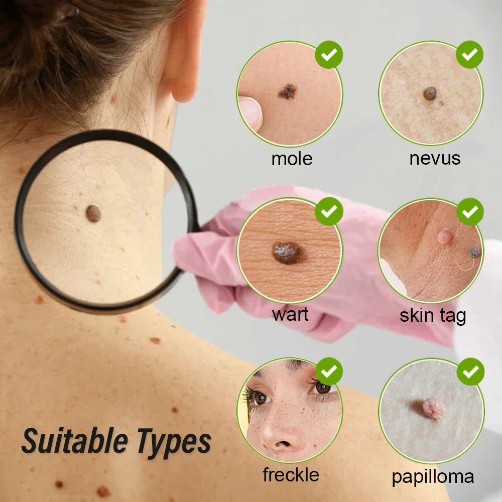 ClearMole™ – Precision Spot Removal Made Easy