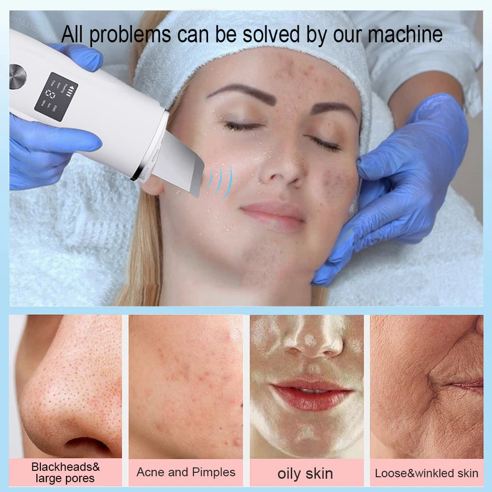 ClearWave™ Ultrasonic Skin Scrubber